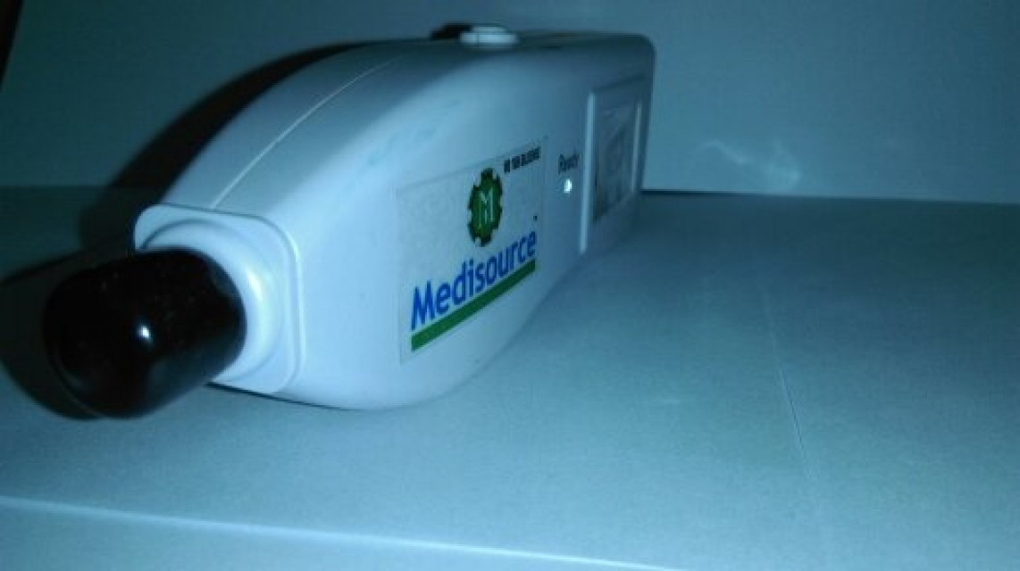 Infant Baby Digital Bilirubin Check Meter - Reliable Bilirubin Detection Solution