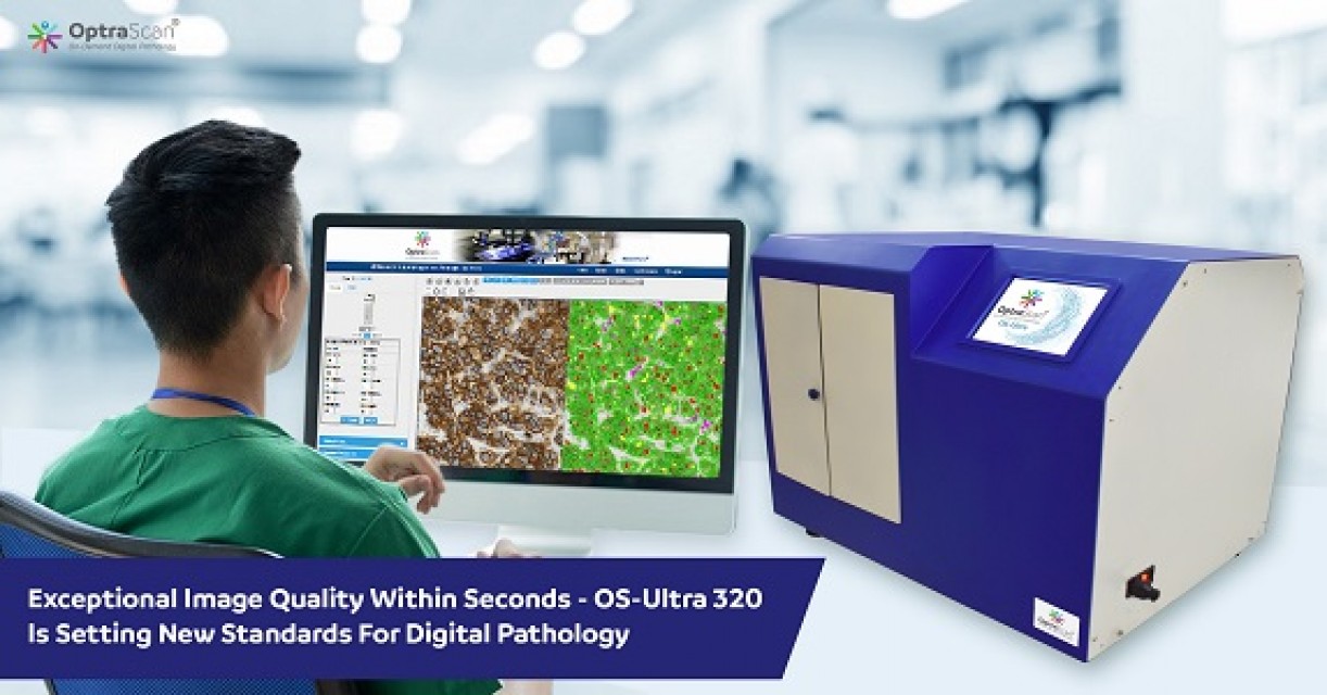 OS-Ultra World’s First Affordable High-Speed Digital Pathology Scanner