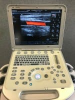 Mindray M7 Ultrasound Machine - Advanced Compact System for Medical Imaging