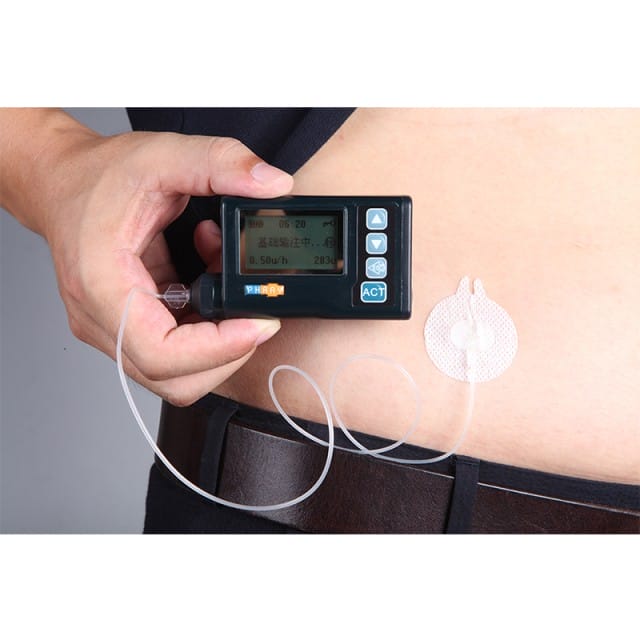 Insulin Pump Infusion Tube for Efficient Diabetes Management