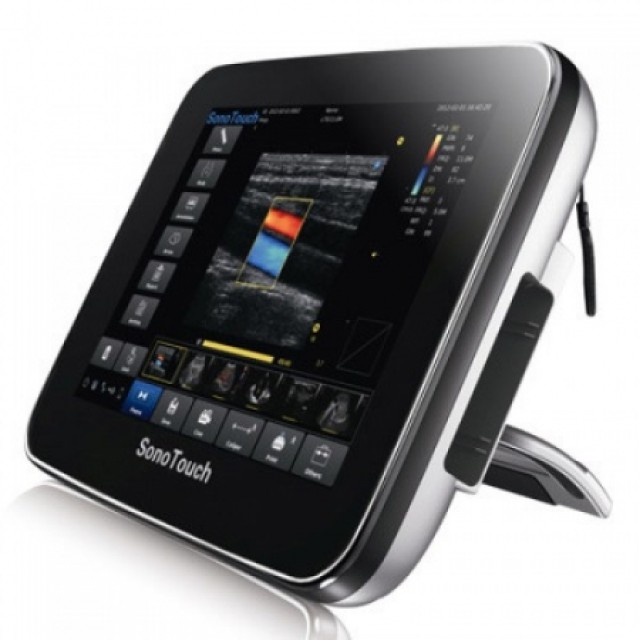Chison Sonotouch 30 Portable Ultrasound - Advanced Imaging Solution for Professionals