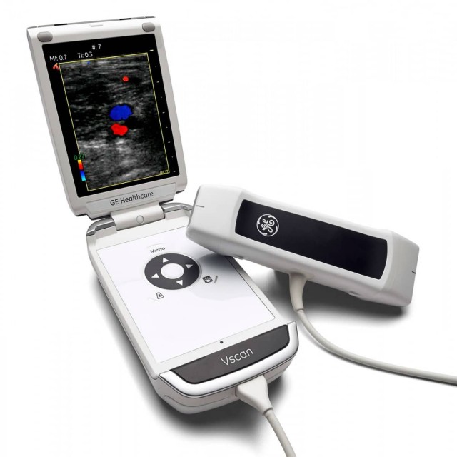 Dual Probe Portable Ultrasound with Innovative Dual Transducers