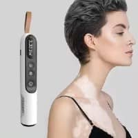 UVB Light Therapy 308nm Small Area Vitiligo - High Quality Treatment, Supplier