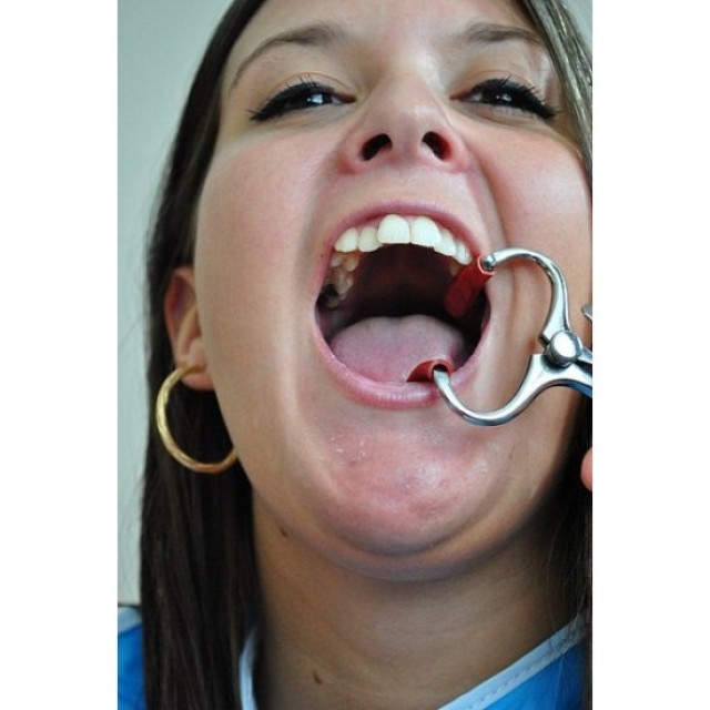 Dental Mouth Gag with Silicon Tip - Silver - Model AHE963