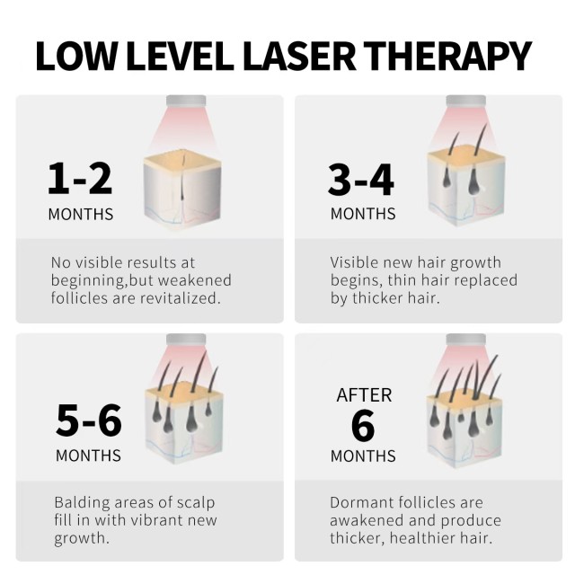 Laser Cap for Hair Growth System – Effective Hair Regrowth Treatment for Men & Women