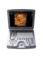 GE Voluson e Ultrasound Machine – Portable, Imaging for Medical Facilities