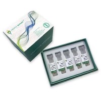 Active Recombinant Mouse Angpt2 Protein C-6×His Tagged for Endothelial Cell Studies
