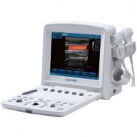 Edan U50 Prime Diagnostic Ultrasound System